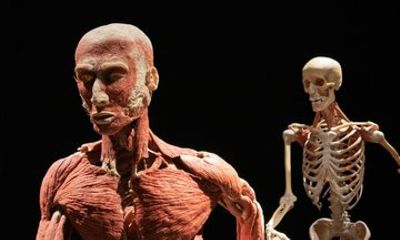 Amsterdam City Audio Tour and Body Worlds Ticket